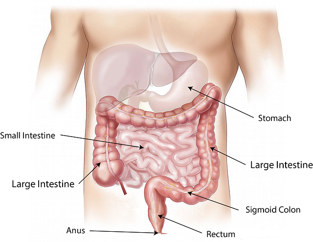Unveiling Diverticulitis Causes, Symptoms, and Treatment